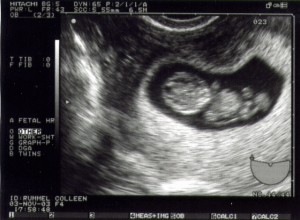 baby_front_view