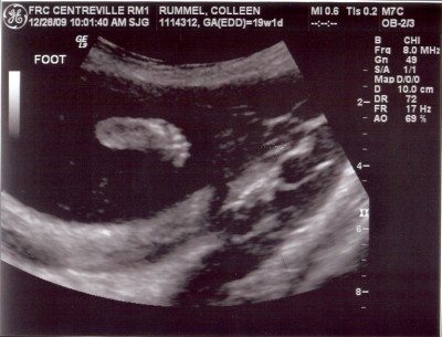 Yay! He has at least 5 toes!