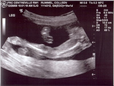 We're not quite sure what the heck he's doing there.